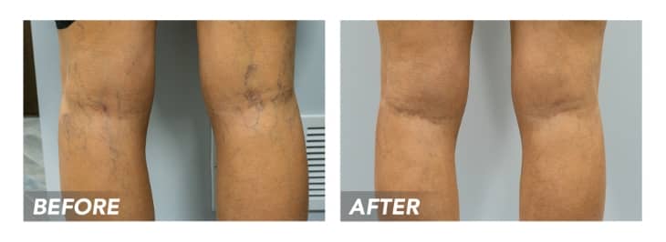 dummy-image-m If you’re looking for a vein doc in Texas, you’ve come to the right place. We provide valuable tips on finding the most reputable and highly-trained vein doctors in Texas.