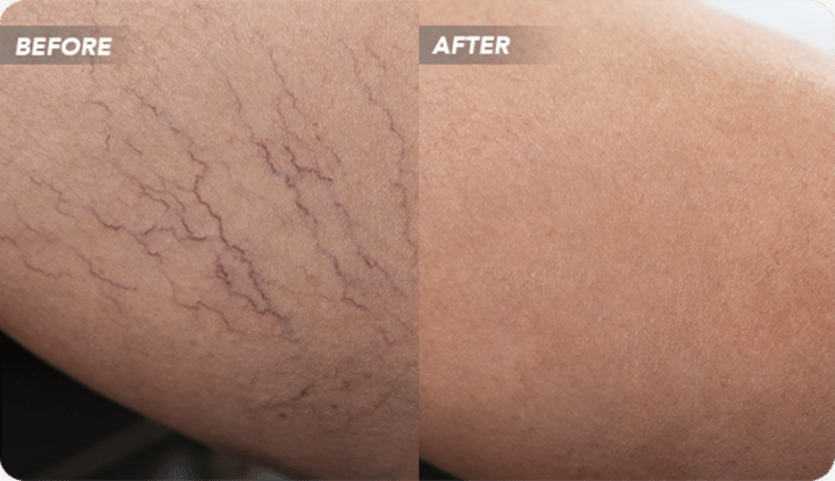7 Tips on Finding a Good Vein Dr. in Houston
