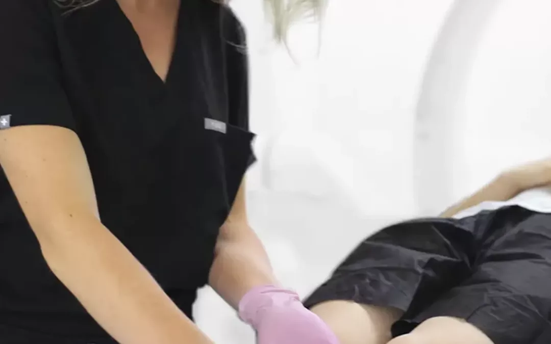 What is the treatment for varicose veins? Our vein doctors describe vein treatments in Texas
