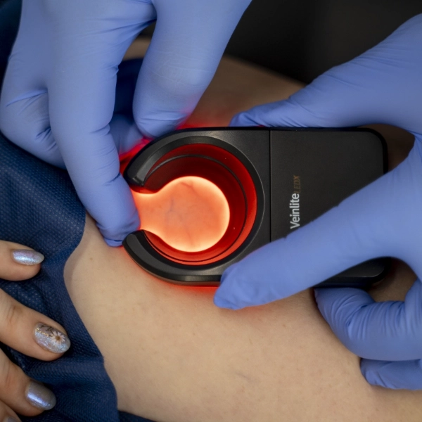 Dr_Byron_veinlite_optimized_optimized A healthcare provider performs an ultrasound exam on a patient in a clinical setting.